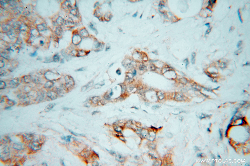 CES2 Polyclonal antibody