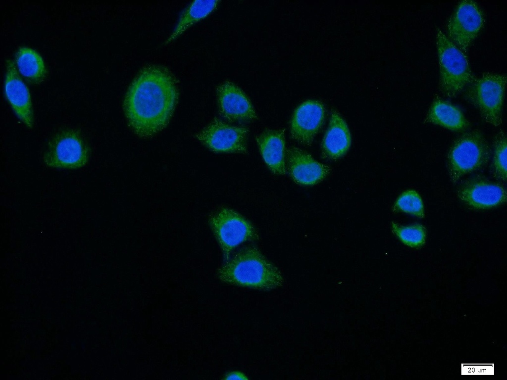 SURF1 Polyclonal antibody