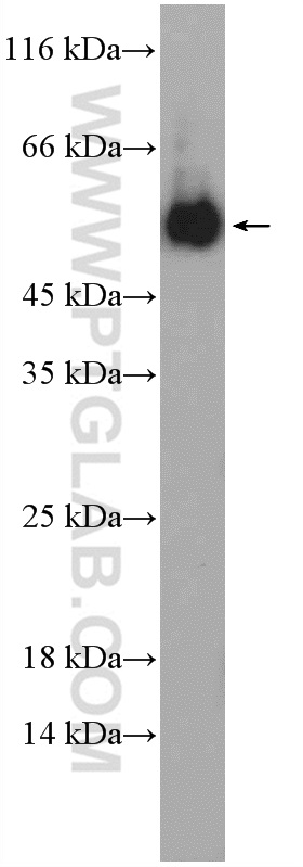 NDP Polyclonal antibody