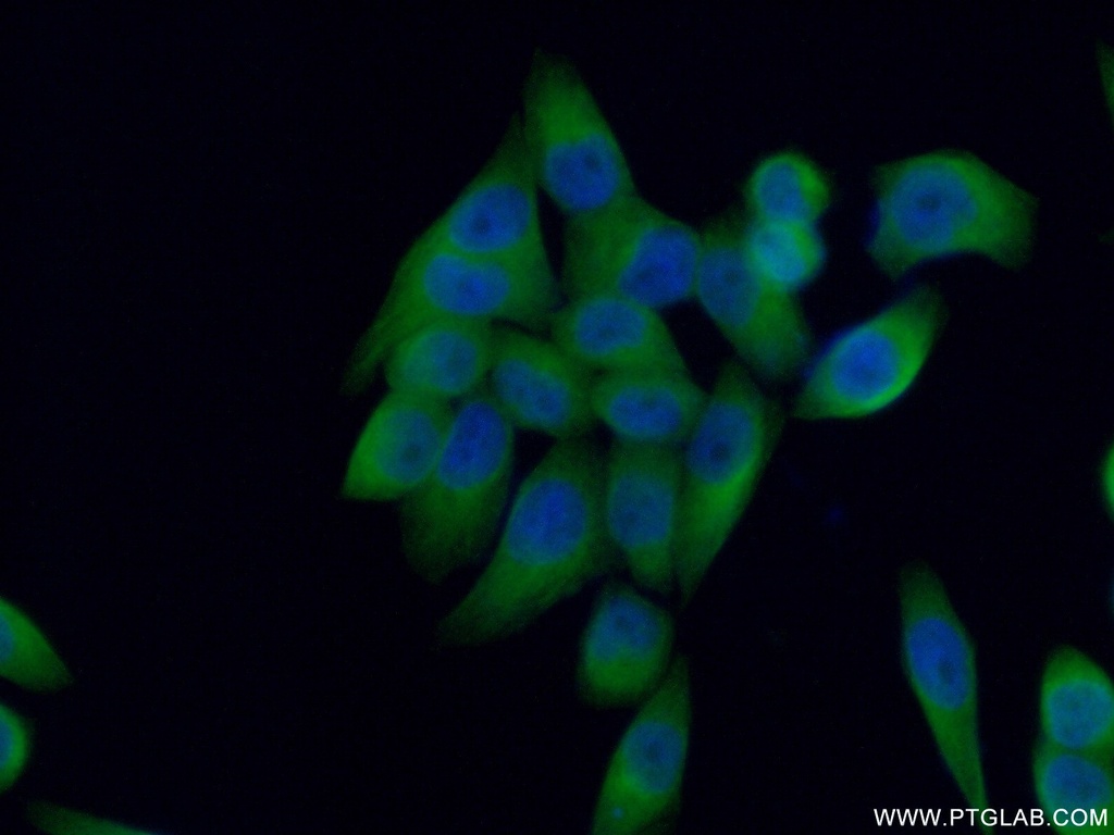 NUBP2 Polyclonal antibody