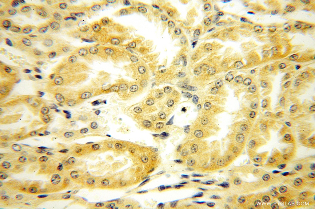 FAPP2 Polyclonal antibody
