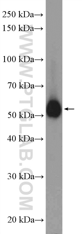 PRPF19 Polyclonal antibody