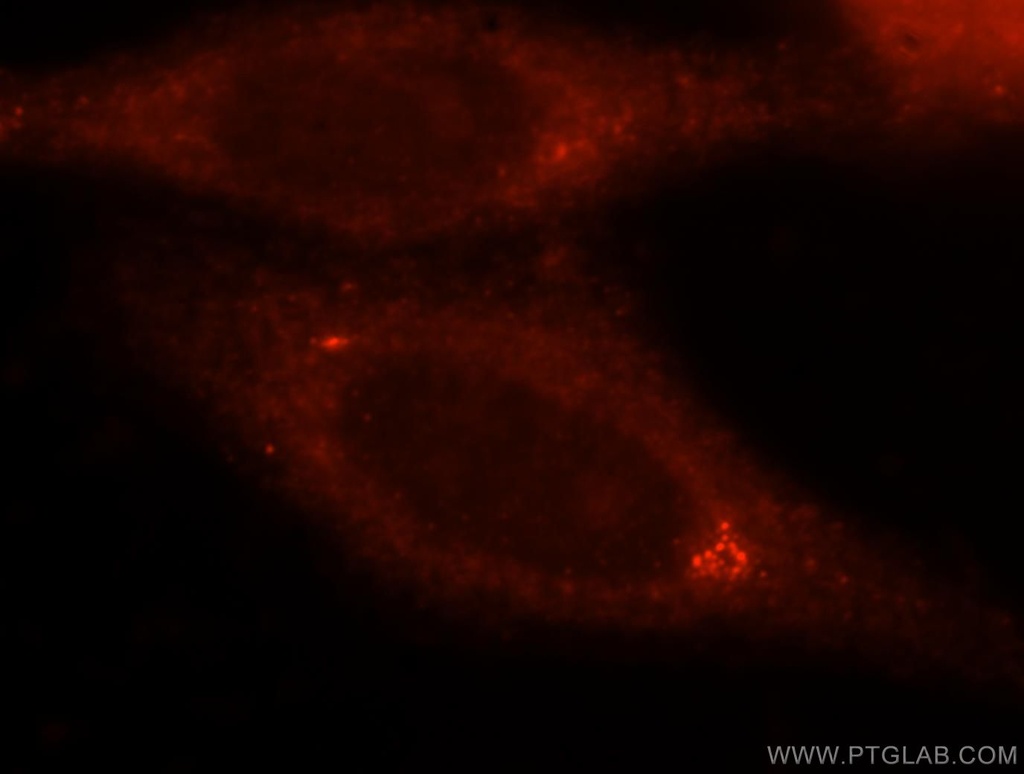 ANXA9 Polyclonal antibody