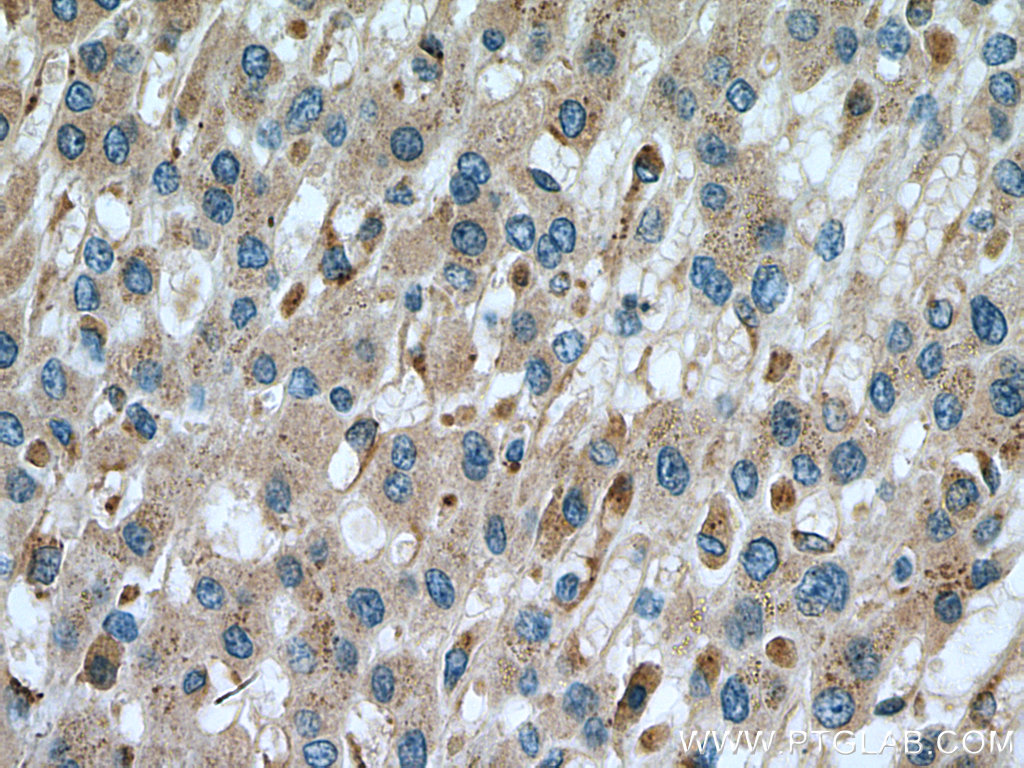 Alpha Galactosidase A Polyclonal antibody