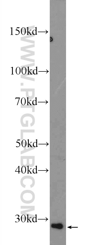 PPT2 Polyclonal antibody