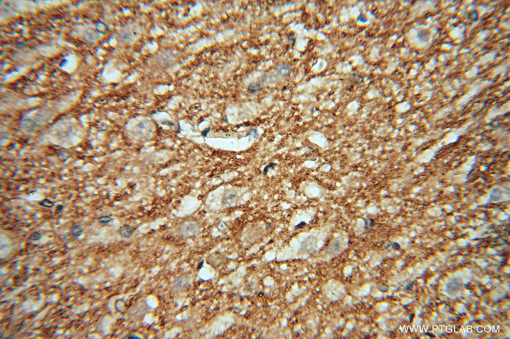 CA11 Polyclonal antibody