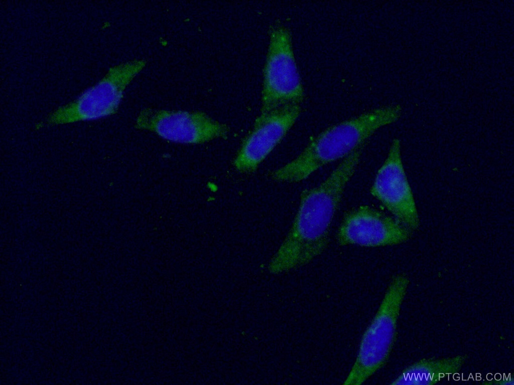 AKR1B1 Polyclonal antibody