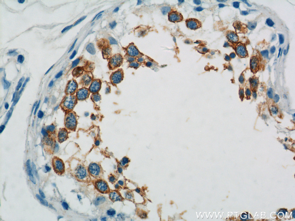 TEX101 Polyclonal antibody