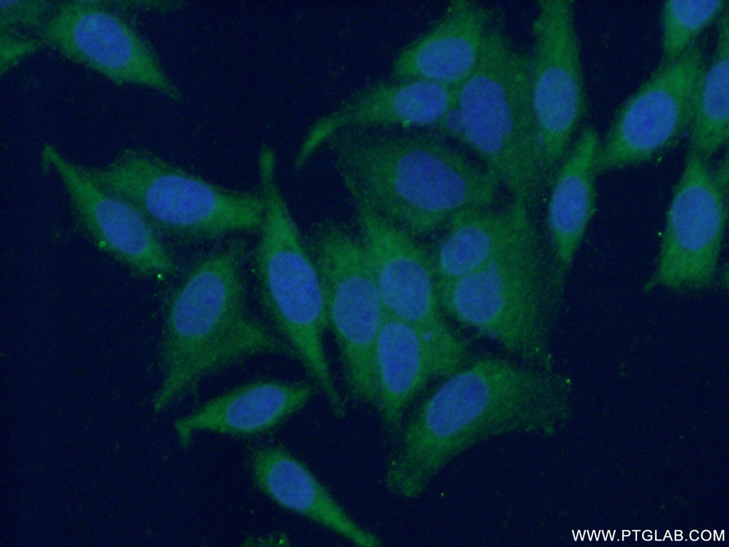 FA2H Polyclonal antibody