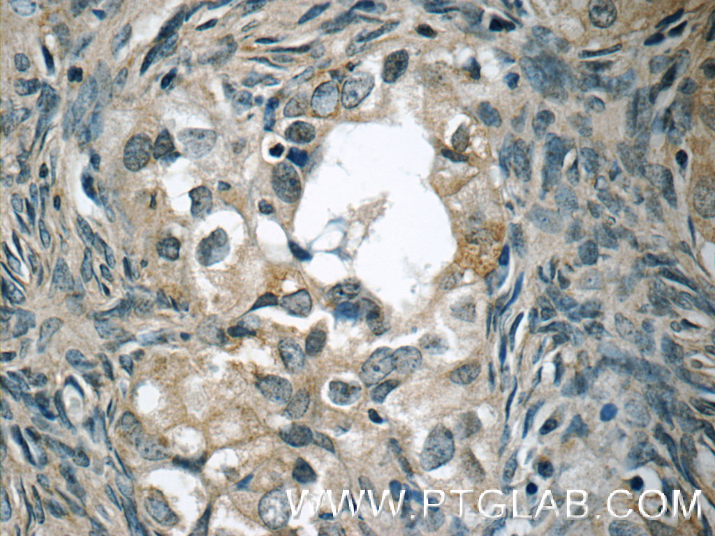 WIT1 Polyclonal antibody