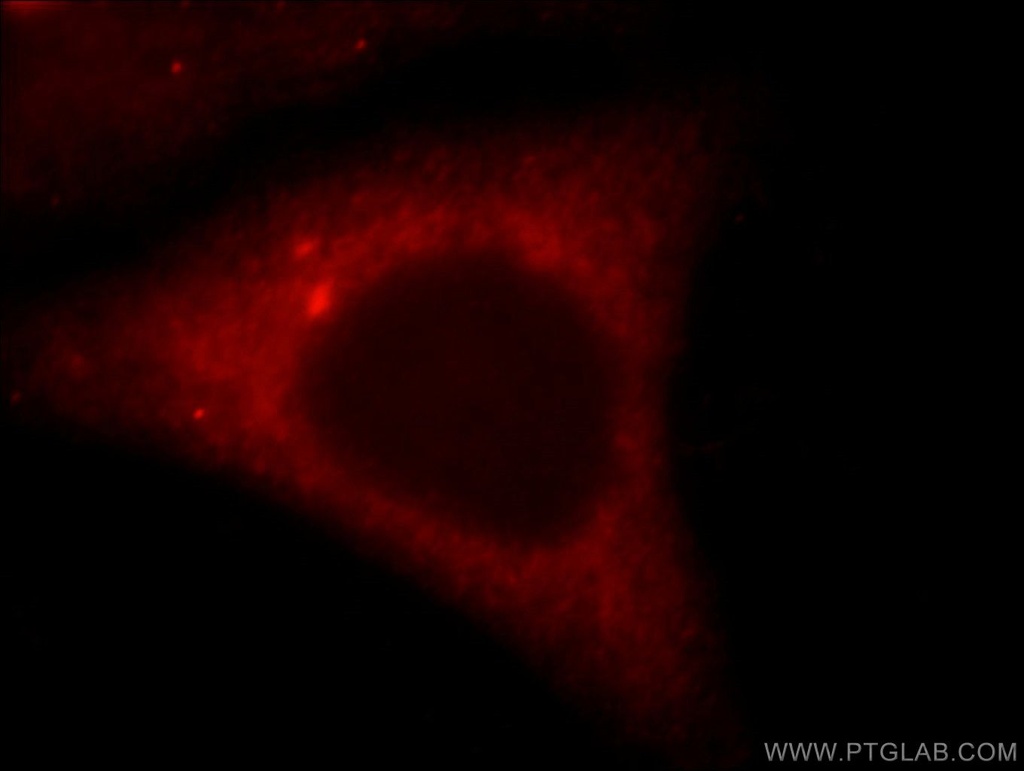 TNIP2 Polyclonal antibody