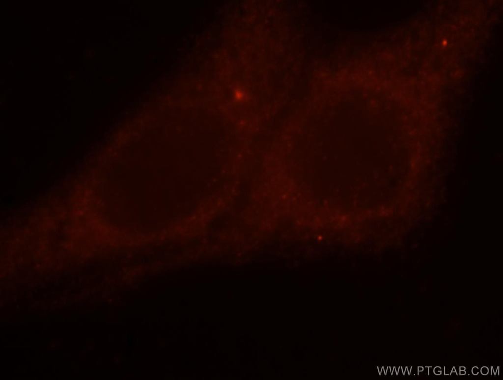 DLC1 Polyclonal antibody