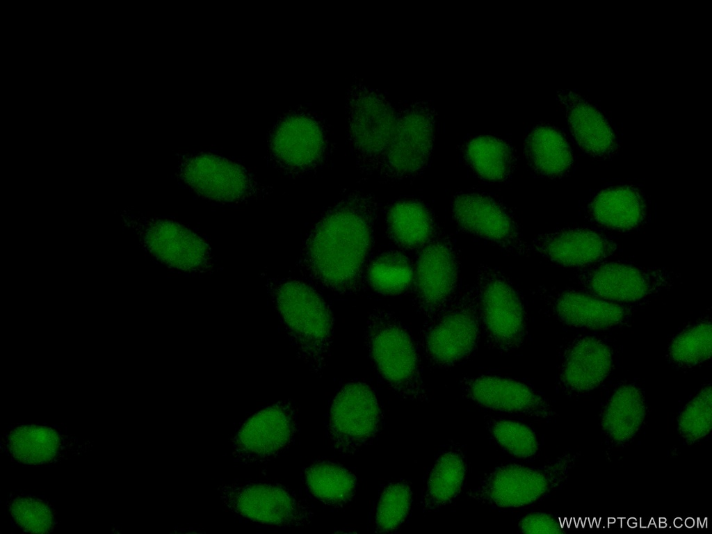 RPP25 Polyclonal antibody
