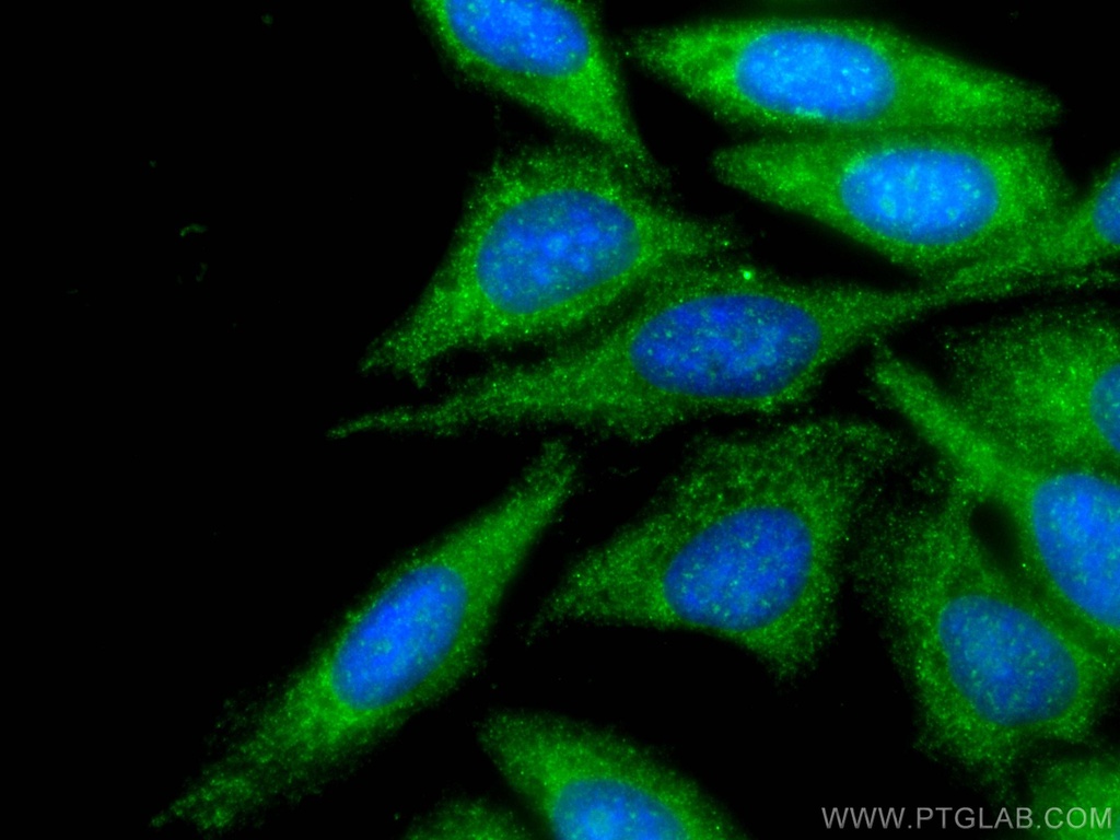 MAPKAP1 Polyclonal antibody