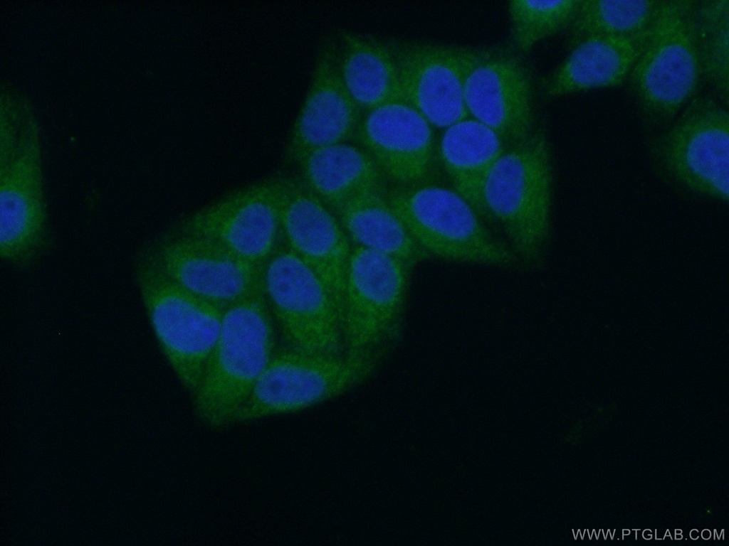 CYB5B Polyclonal antibody