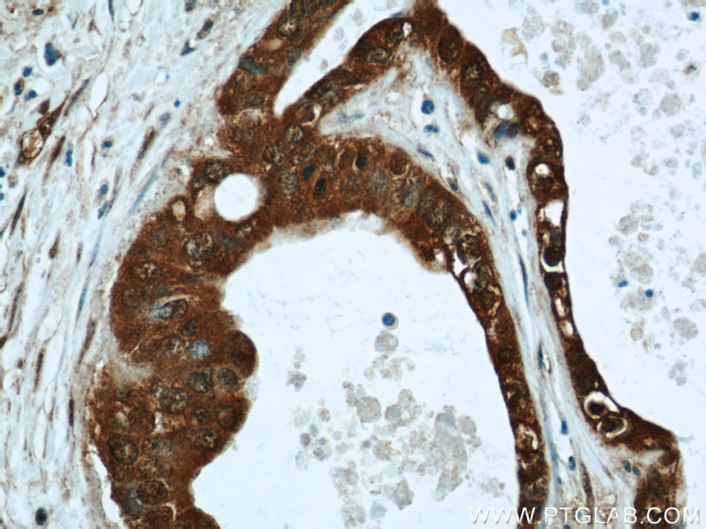 LIMD2 Polyclonal antibody