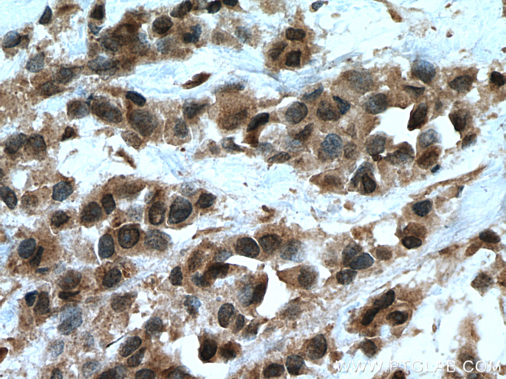UBE2D1/2/3/4 Polyclonal antibody