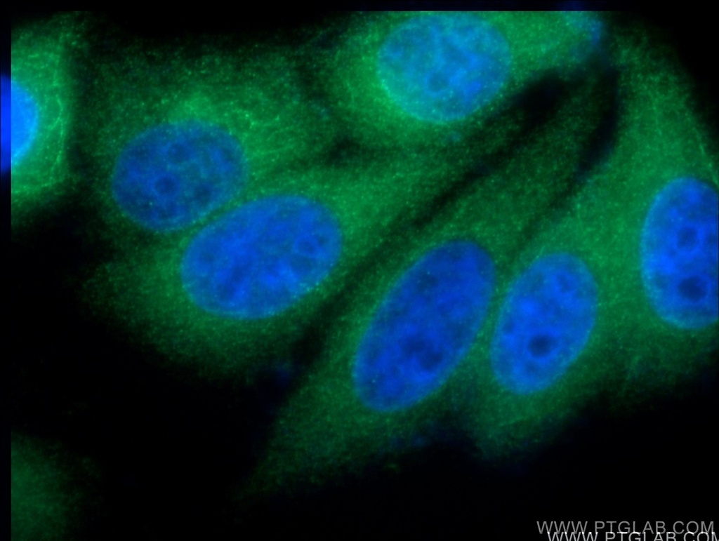 VPS28 Polyclonal antibody