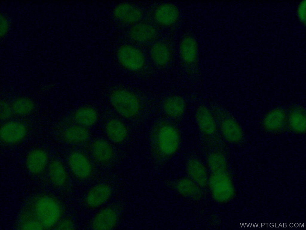 ADAT1 Polyclonal antibody