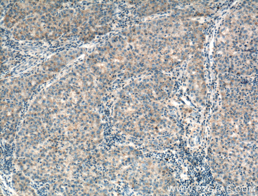 RAB31 Polyclonal antibody