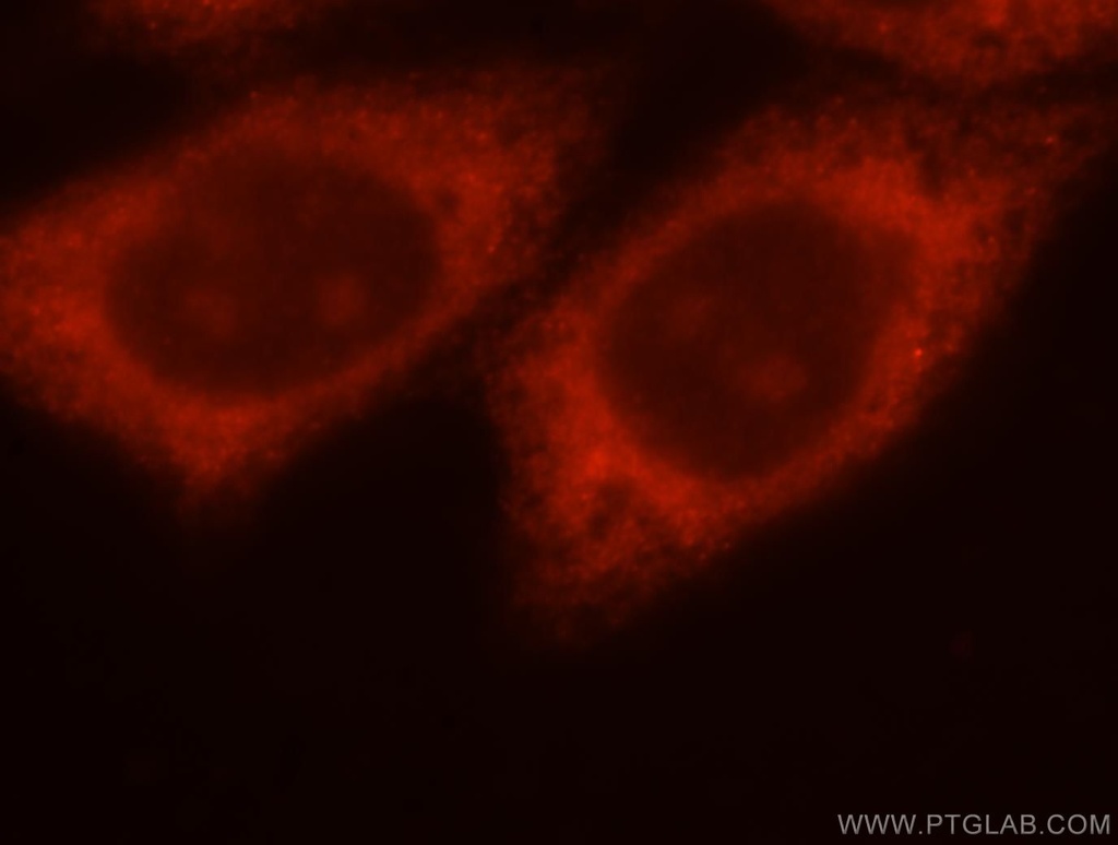 THTPA Polyclonal antibody