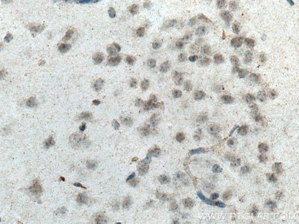 SCNM1 Polyclonal antibody