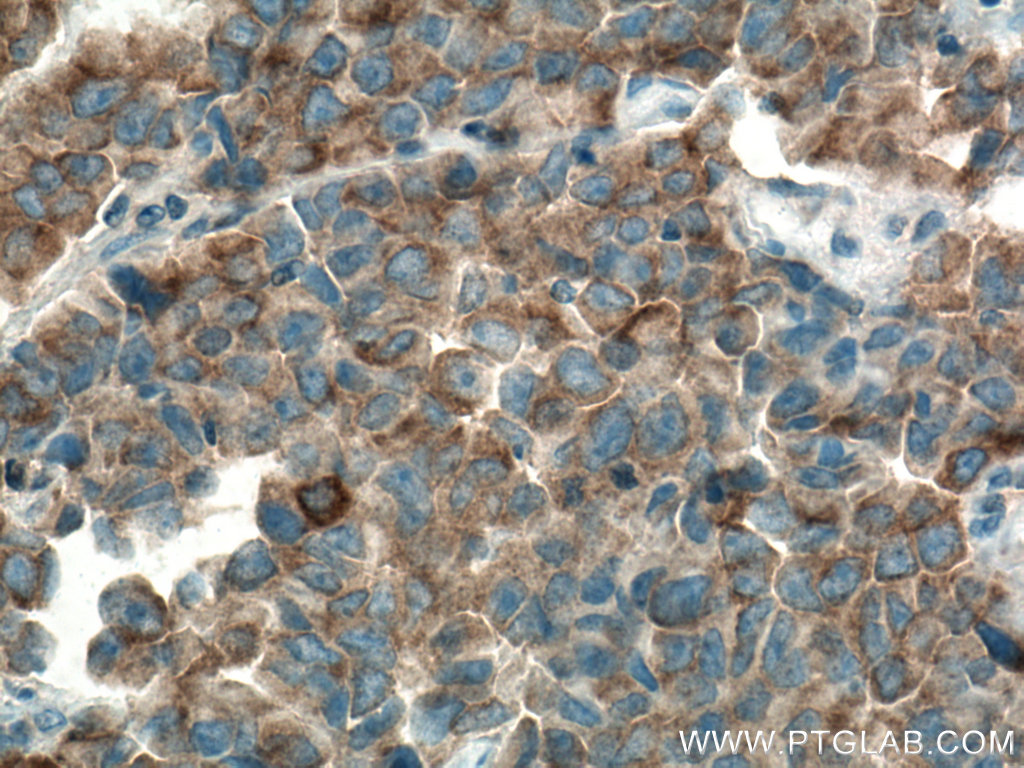 MARK2 Polyclonal antibody