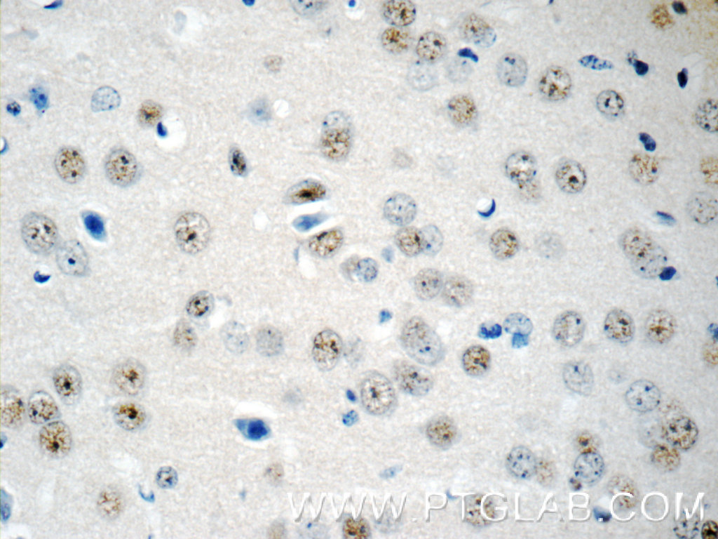 RUNX1T1 Polyclonal antibody