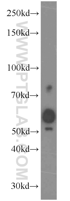 SPO11 Polyclonal antibody