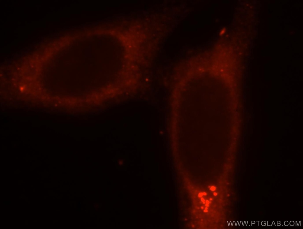 SMU1 Polyclonal antibody
