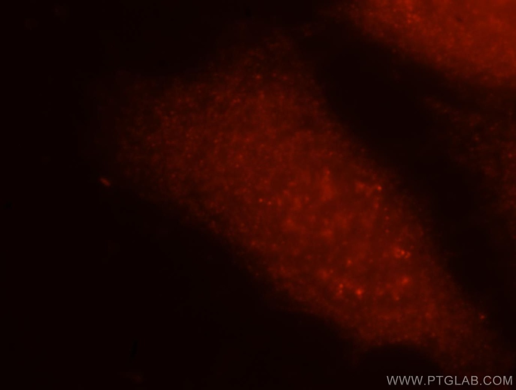 GMPPA Polyclonal antibody
