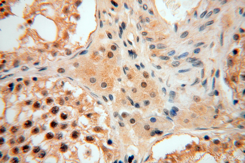PPM1G Polyclonal antibody