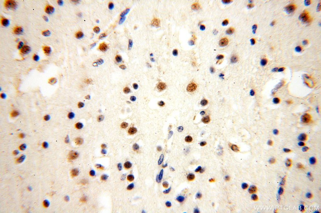 WDR5 Polyclonal antibody