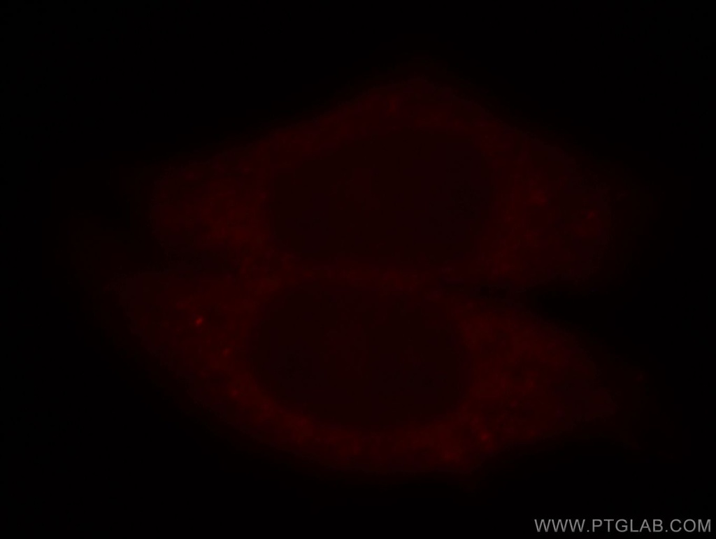 PRPS1 Polyclonal antibody