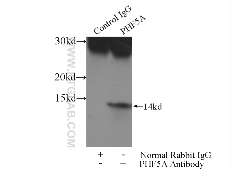 PHF5A Polyclonal antibody