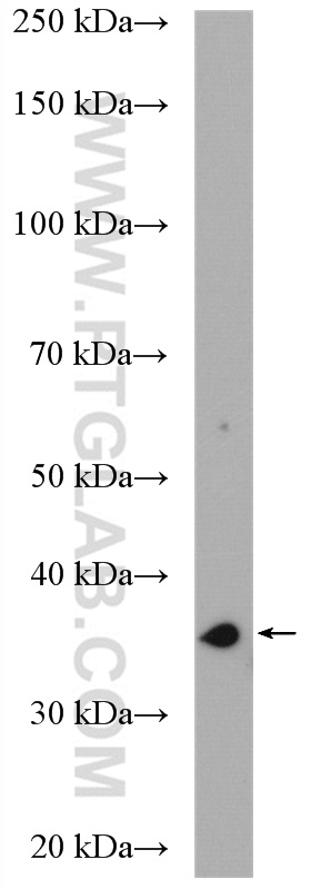 DIMT1L Polyclonal antibody