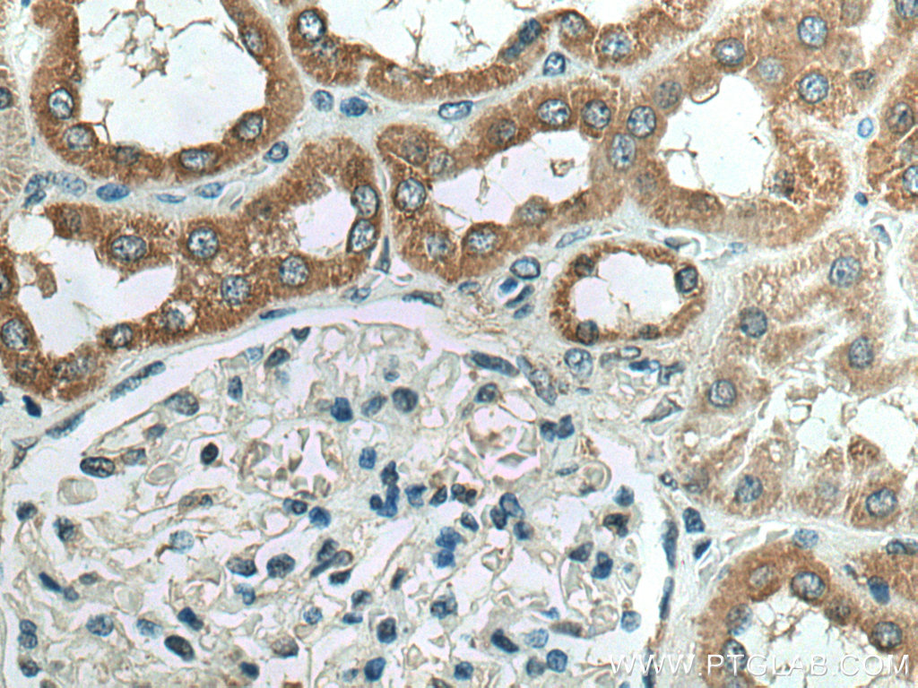 NDUFC2 Polyclonal antibody