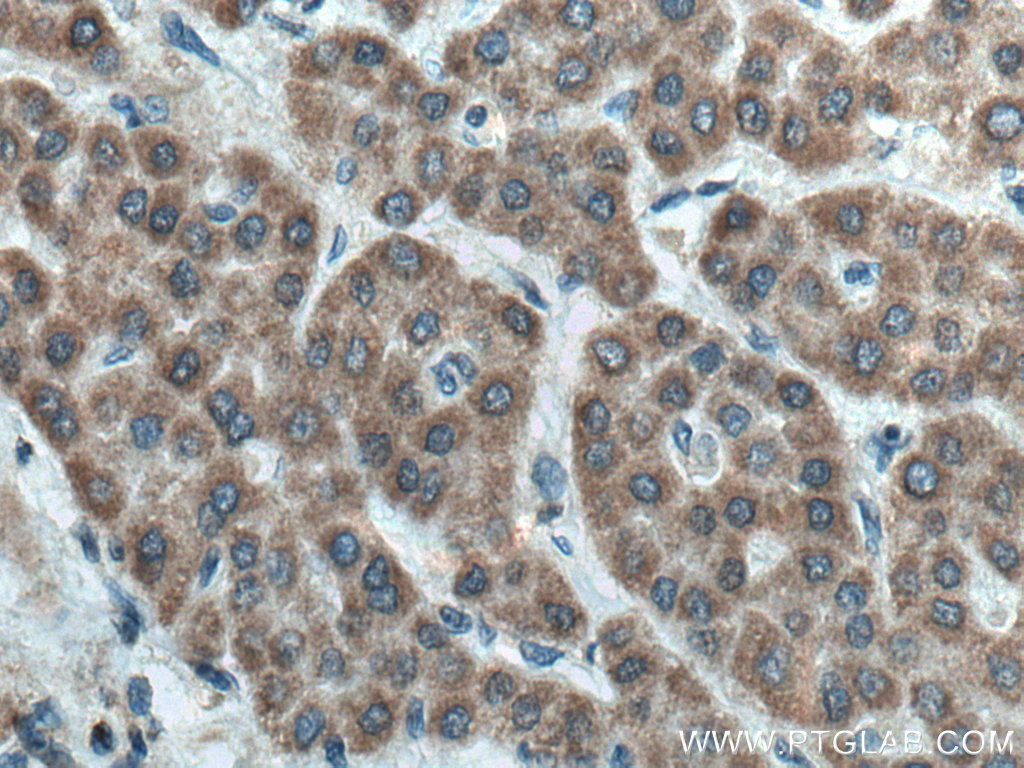 FDXR Polyclonal antibody