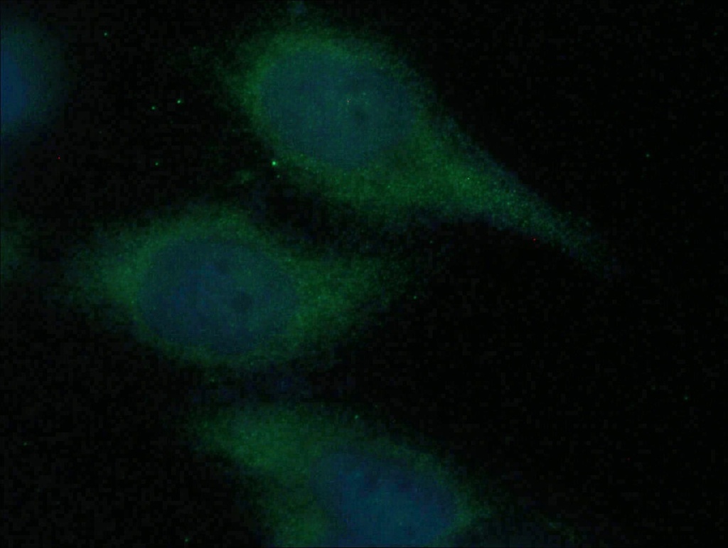 CDCA3 Polyclonal antibody