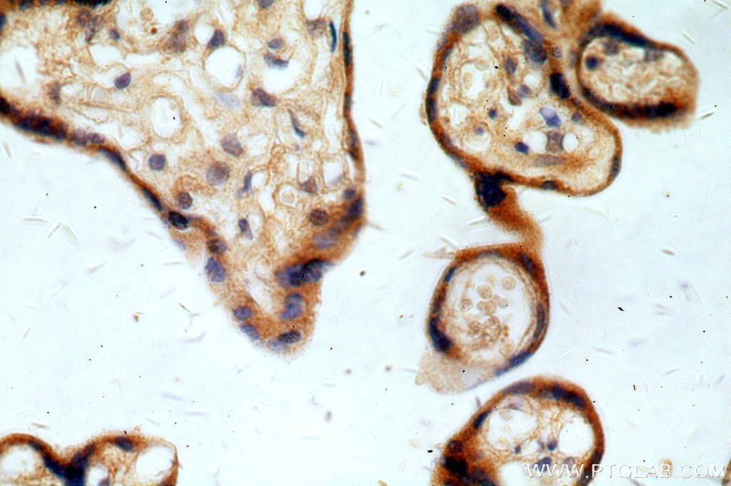 REXO2 Polyclonal antibody