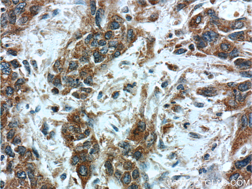 PSMG3 Polyclonal antibody