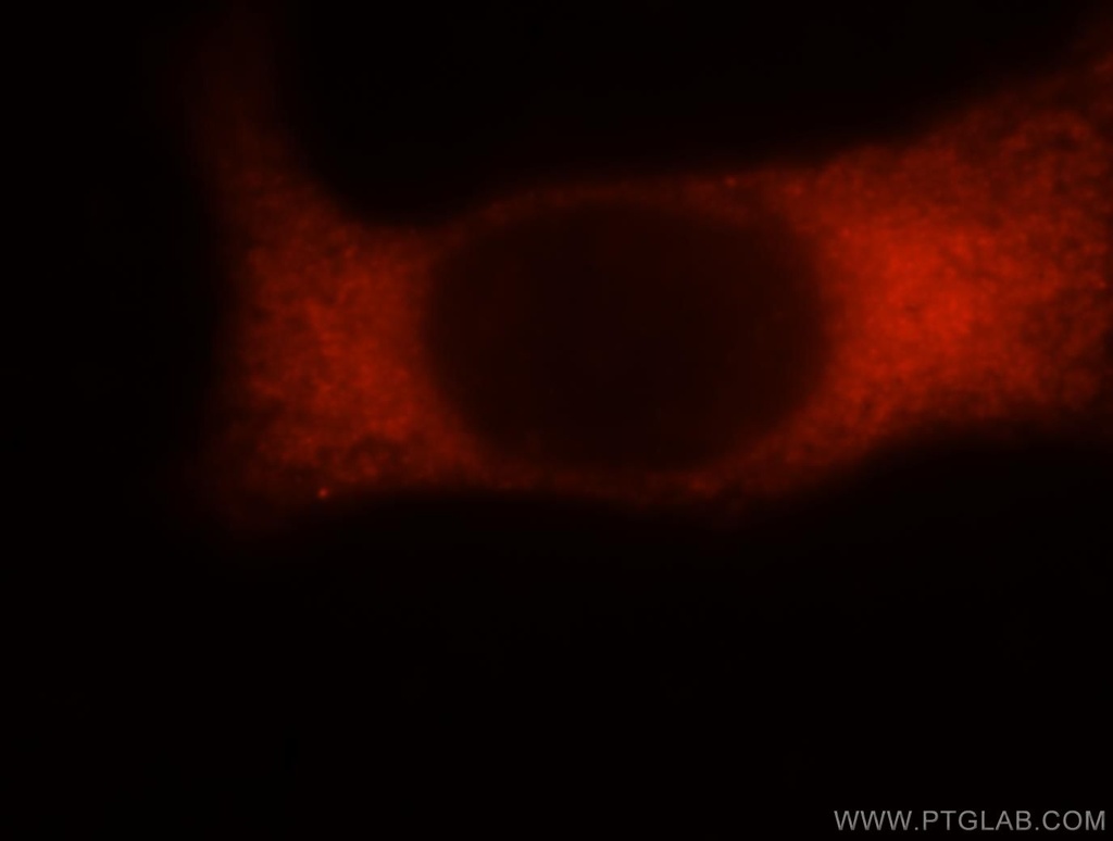 RPS16 Polyclonal antibody