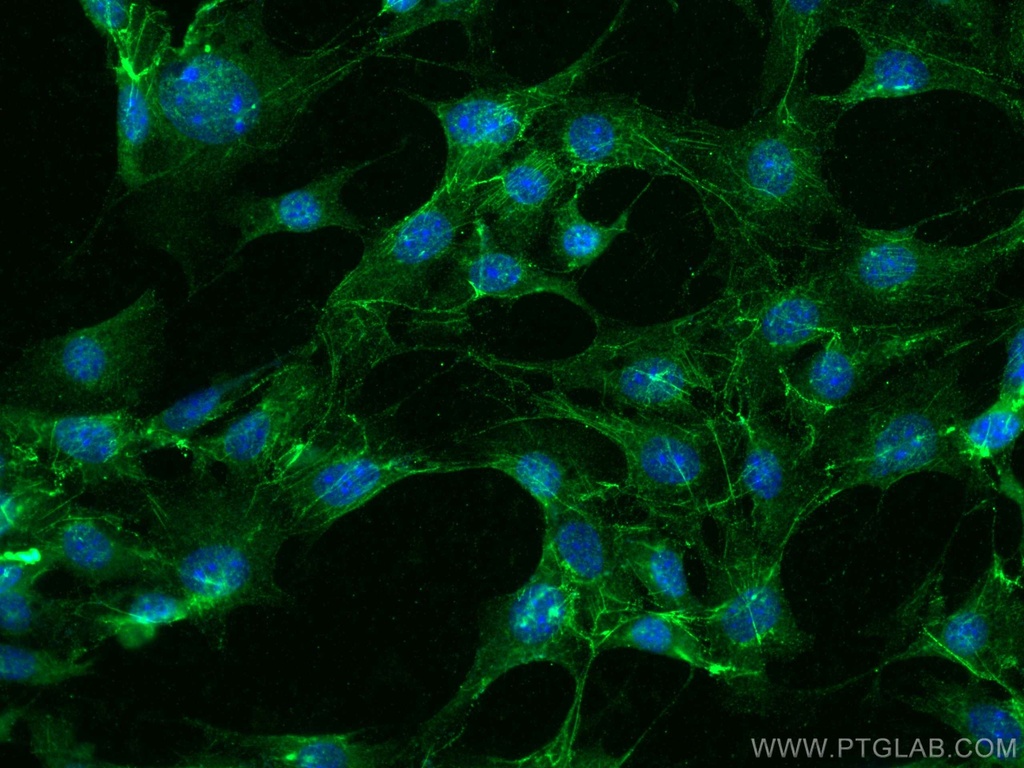 Fibronectin Polyclonal antibody