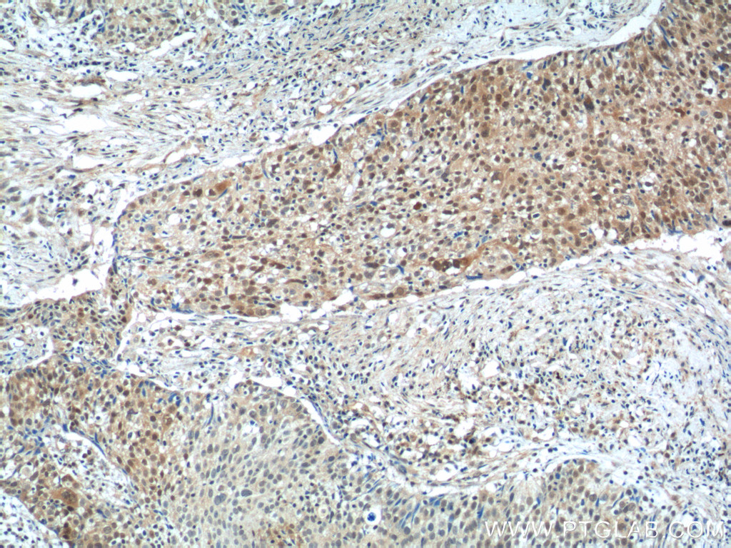NSFL1C Polyclonal antibody