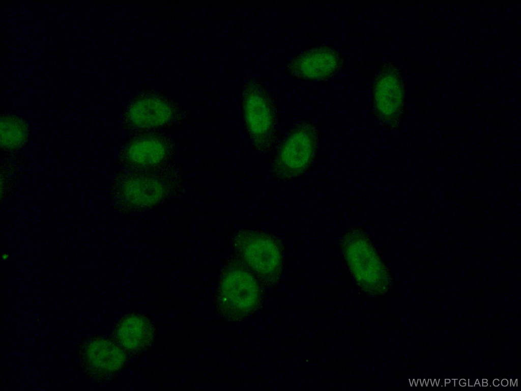 RNF40 Polyclonal antibody