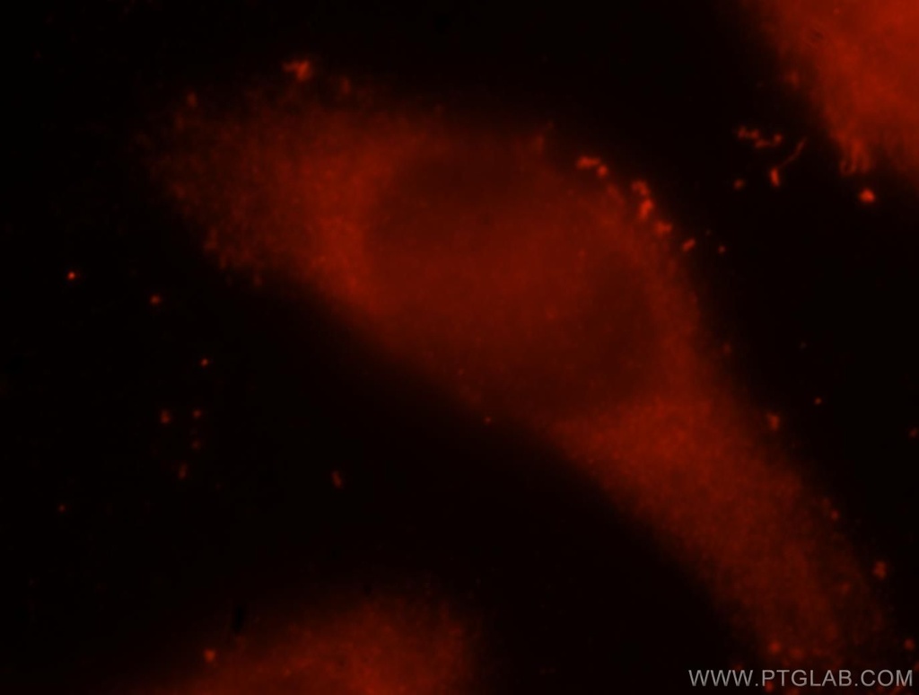 ICA1L Polyclonal antibody