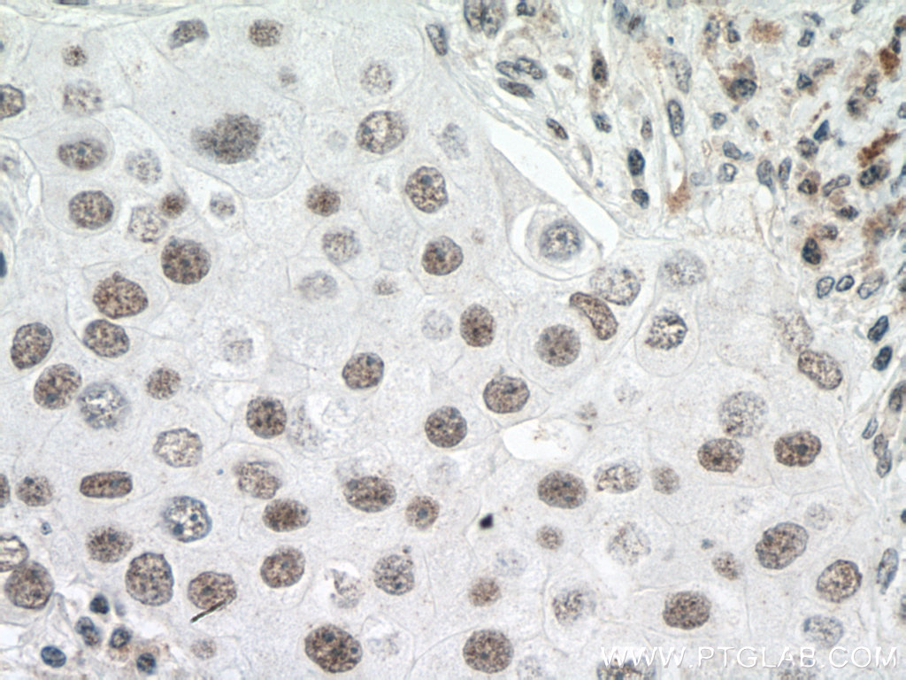 U2AF65 Polyclonal antibody