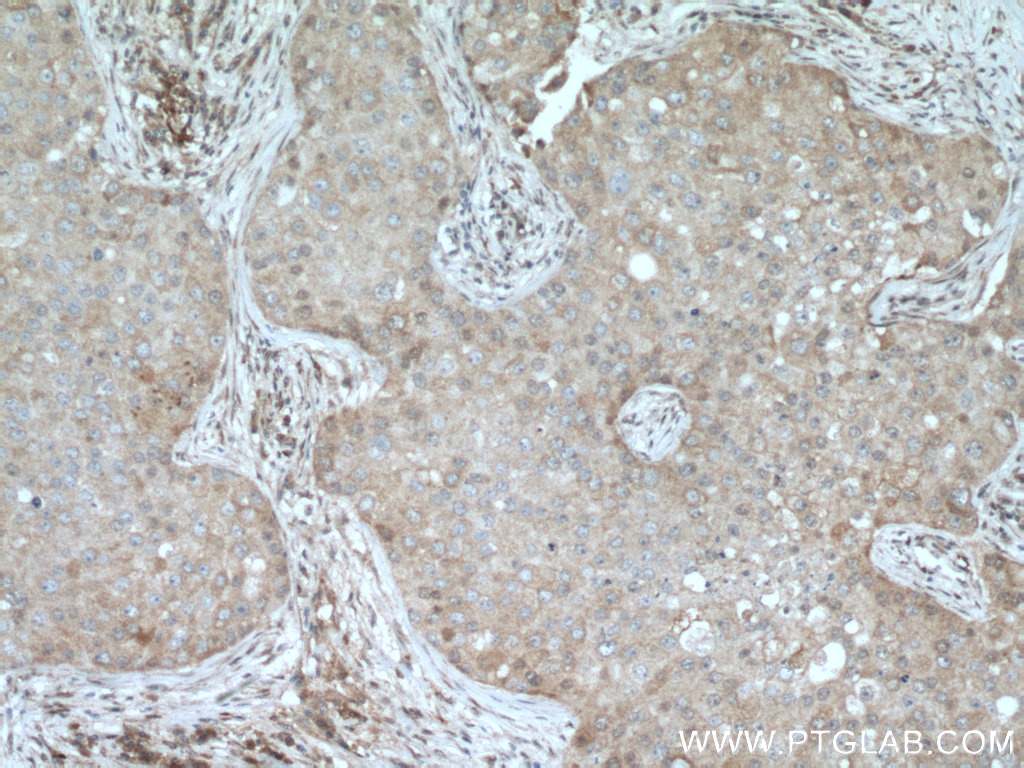 DUS3L Polyclonal antibody