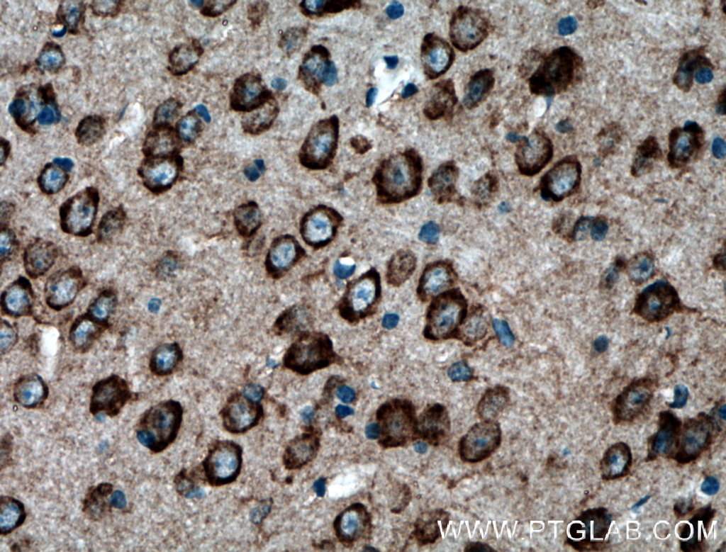 PDK2 Polyclonal antibody