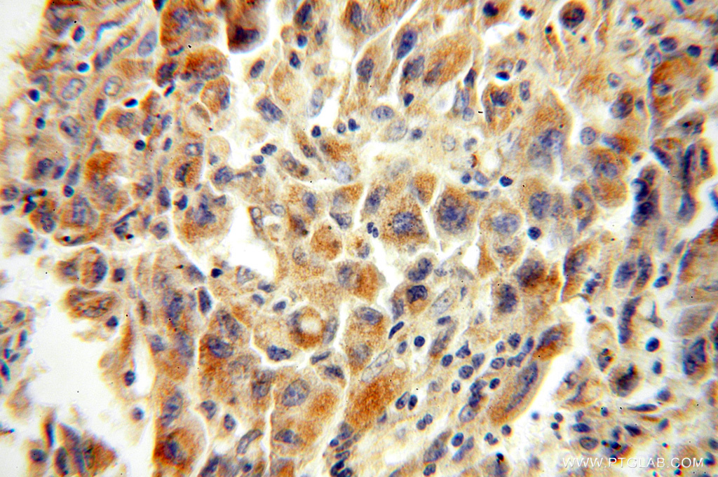 XPNPEP3 Polyclonal antibody